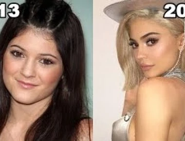 Βίντεο: 10 διάσημοι που δεν θα πιστεύετε πόσο έχουν αλλάξει